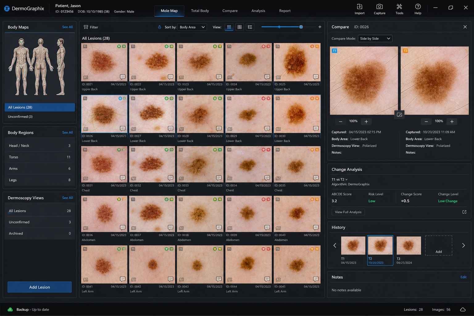 Digital mole mapping software interface showing total body photography and dermoscopic mole images used for Mole Mapping Melbourne patients.